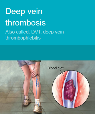 Deep Vein Thrombosis Medical Alert Bracelets Deep Vein Thrombosis Medical Alert Bracelets