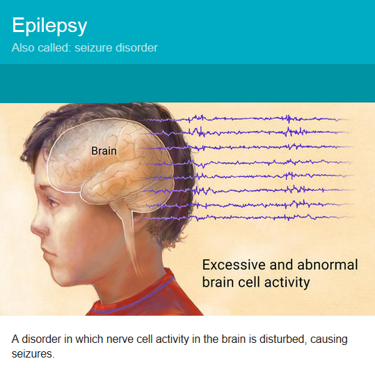 Seizures Medical Alert Bracelets Seizures Medical Alert Bracelets